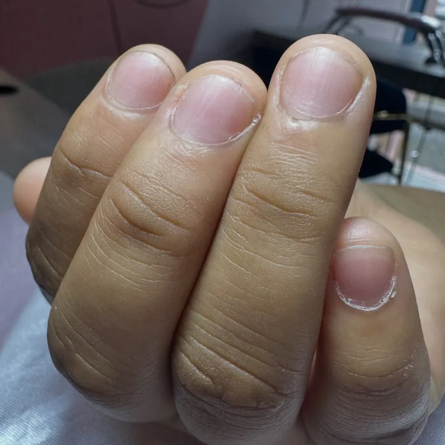 Uñas antes